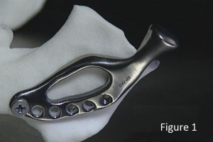 australia-3d-medical-limited-receives-order-25-3d-printed-jaws-successful-surgery-00002[1]